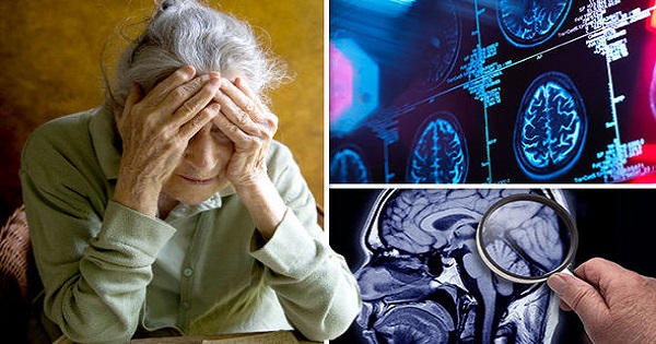 Phân biệt sa sút trí tuệ và Alzheimer: Hiểu đúng để không bỏ lỡ giai đoạn vàng điều trị
