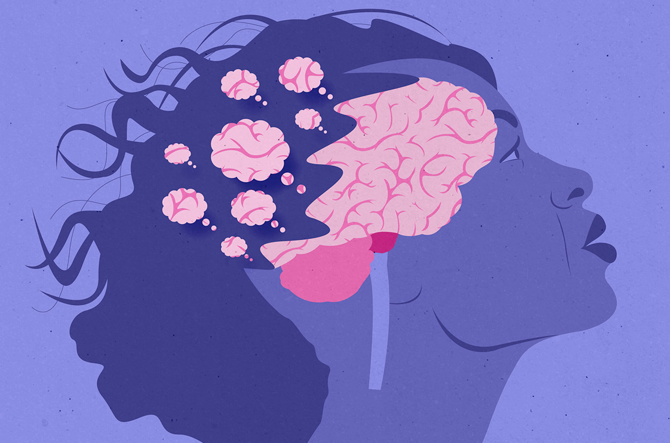Biến đổi não ở phụ nữ mãn kinh: Phát hiện đáng lo ngại liên quan đến Alzheimer