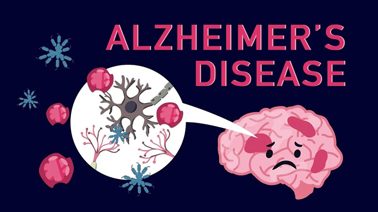 Test Nhận Thức Và Trắc Nghiệm Tâm Lý: Giải Pháp Phát Hiện Sớm Sa Sút Trí Tuệ Và Alzheimer